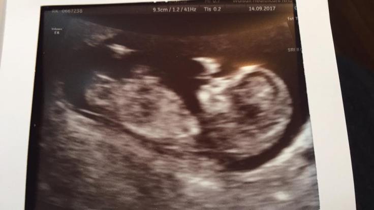 21728463_10155429788660813_7692325394936531706_n